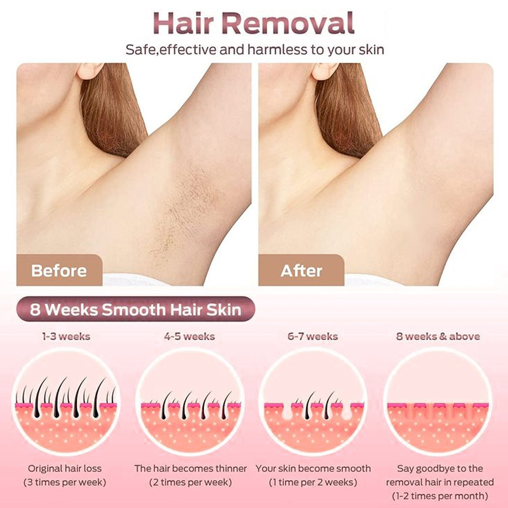 Latest company case about How Much Does Full Body Laser Hair Removal Cost in Usa