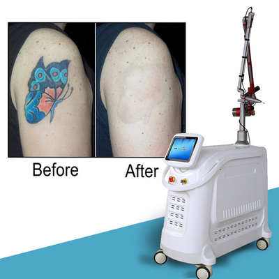 4 Wavelengths Nd YAG Q Switch Laser Machine Tattoo Removal Stationary Style