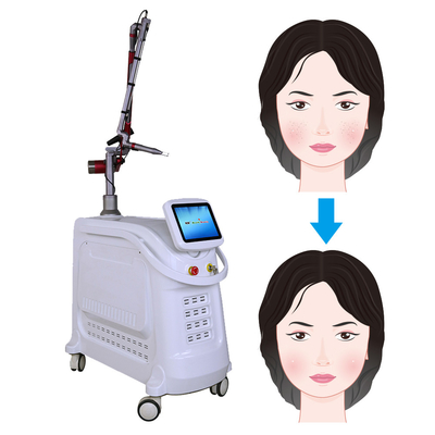 Pico Laser Machine 532nm 1064nm 755nm Q Switch Nd YAG Laser Equipment