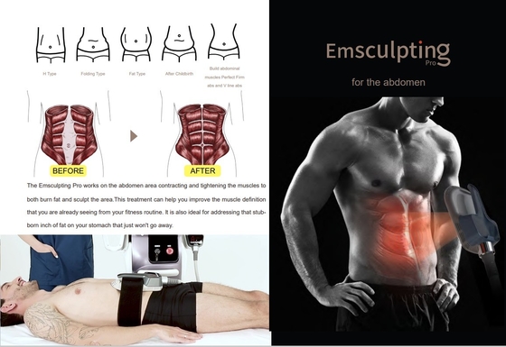 Advanced EMS Slimming Machine 150HZ Frequency For Cellulite Reduction