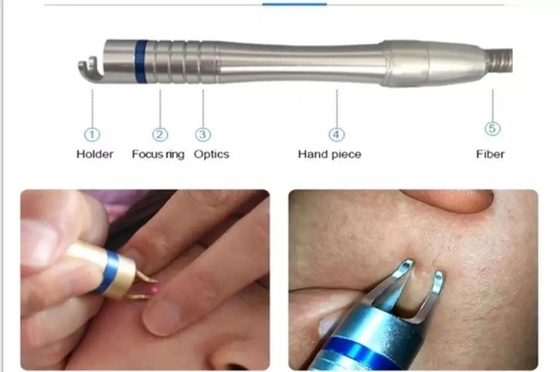 15W 30W Laser Vascular Removal machine for Toenail Treatment / Hot Laser Skin Rejuvenation