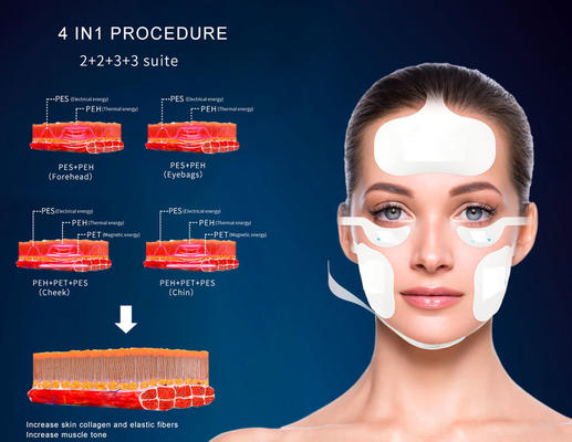 Vertical Magnetic Facial Ems rf Skin Rejuvenation Lifting Skin Tightening slimming Rf Lifting Machine machifor sal