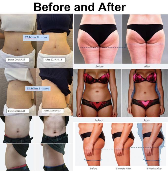600w 5 Handles EMS Sculpting Machine For Neo RF 14 Tesla Bodi Sculpting Body Slimming 10